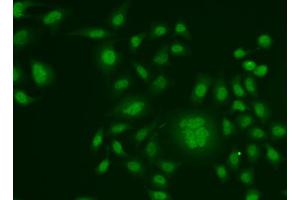 Immunofluorescence analysis of HeLa cells using ERCC1 antibody (ABIN5973037). (ERCC1 Antikörper)