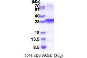 UNG Protein (AA 1-229) (His tag)