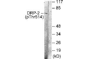 Immunohistochemistry analysis of paraffin-embedded human brain tissue using DRP-2 (Phospho-Thr514) antibody. (DRP2 Antikörper  (pThr514))