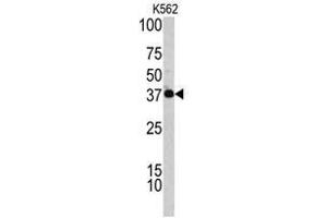 Image no. 1 for anti-Complement Factor H-Related 1 (CFHR1) (C-Term) antibody (ABIN452839) (CFHR1 Antikörper  (C-Term))
