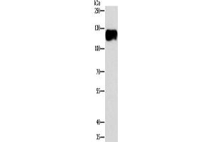 Western Blotting (WB) image for anti-Calpastatin (CAST) antibody (ABIN2423036) (Calpastatin Antikörper)