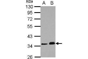 WB Image Sample (30 ug of whole cell lysate) A: A431 B: HeLa 10% SDS PAGE antibody diluted at 1:1000 (PPM1J Antikörper)
