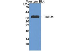 Western blot analysis of the recombinant protein. (SERPINC1 Antikörper  (AA 150-426))