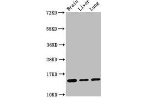 Western Blot Positive WB detected in: Mouse brain tissue, Rat liver tissue, Rat lung tissue All lanes: Histone H2B type 1-K antibody at 0. (Rekombinanter HIST1H2BK Antikörper)