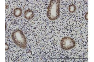 Image no. 2 for anti-AF4/FMR2 Family, Member 4 (AFF4) (AA 1-109) antibody (ABIN466197) (AFF4 Antikörper  (AA 1-109))