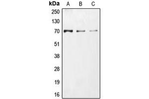 Western blot analysis of CDC25A (pS75) expression in HEK293T UV-treated (A), Jurkat UV-treated (B), NIH3T3 (C) whole cell lysates. (CDC25A Antikörper  (pSer75))