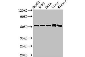 Western Blot Positive WB detected in: HepG2 whole cell lysate, K562 whole cell lysate, Hela whole cell lysate, Mouse liver tissue, Mouse kidney tissue All lanes: FBXW2 antibody at 3 μg/mL Secondary Goat polyclonal to rabbit IgG at 1/50000 dilution Predicted band size: 52, 45 kDa Observed band size: 52 kDa (FBXW2 Antikörper  (AA 72-340))