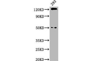 Western Blotting (WB) image for anti-Cadherin 1, Type 1, E-Cadherin (Epithelial) (CDH1) (AA 23-621) antibody (ABIN7146195)