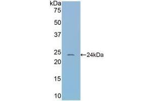 Detection of Recombinant CBG, Mouse using Polyclonal Antibody to Corticosteroid Binding Globulin (CBG) (SERPINA6 Antikörper  (AA 57-256))