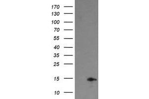 Image no. 1 for anti-Tumor Protein D52-Like 3 (TPD52L3) antibody (ABIN1501478)