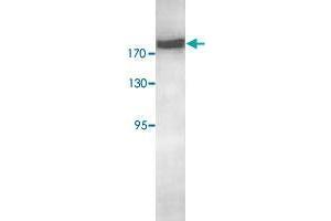 Western blot analysis of HeLa cell lysate with RICTOR polyclonal antibody  at 1 : 500 dilution. (RICTOR Antikörper  (AA 1406-1700))