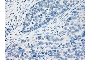 Immunohistochemical staining of paraffin-embedded Kidney tissue using anti-PPP5Cmouse monoclonal antibody. (PP5 Antikörper)
