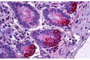 Human Intestine, Paneth Cells: Formalin-Fixed, Paraffin-Embedded (FFPE) (IL12A Antikörper)