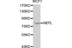 Western blot analysis of extracts of MCF-7 cells, using NEFL antibody. (NEFL Antikörper)