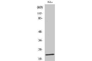 Western Blotting (WB) image for anti-Caveolin 1, Caveolae Protein, 22kDa (CAV1) (pTyr14) antibody (ABIN3181949) (Caveolin-1 Antikörper  (pTyr14))