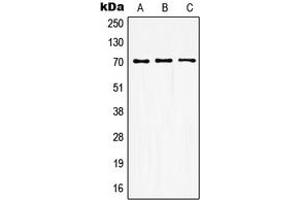 Western blot analysis of GUCY1B3 expression in HEK293T (A), mouse kidney (B), rat kidney (C) whole cell lysates. (GUCY1B3 Antikörper  (N-Term))