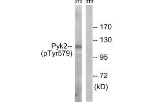 Western Blotting (WB) image for anti-PTK2B Protein tyrosine Kinase 2 beta (PTK2B) (pTyr579) antibody (ABIN1847713) (PTK2B Antikörper  (pTyr579))