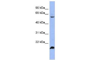WB Suggested Anti-SFRS4 Antibody Titration:  0. (SRSF4 Antikörper  (Middle Region))