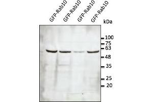 Western Blotting (WB) image for anti-RAB10, Member RAS Oncogene Family (RAB10) (C-Term) antibody (ABIN6254238) (RAB10 Antikörper  (C-Term))