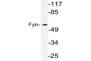 Western blot (WB) analysis of Fyn antibody in extracts from MCF-7 cells. (FYN Antikörper)