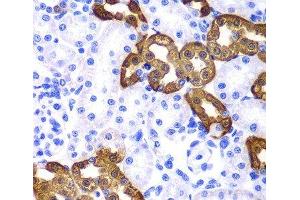 Immunohistochemistry of paraffin-embedded Rat kidney using KRT19 Polyclonal Antibody at dilution of 1:100 (40x lens). (Cytokeratin 19 Antikörper)