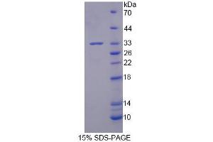 SDS-PAGE analysis of Human BRD2 Protein. (BRD2 Protein)