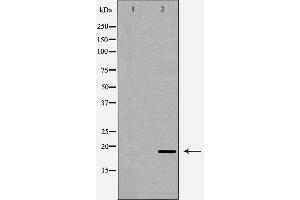 Western blot analysis of extracts of 293, using REG3A antibody.