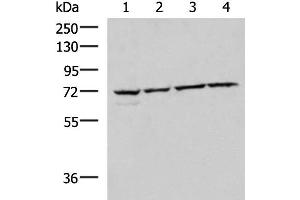 Western Blotting (WB) image for anti-Core-binding Factor, Runt Domain, alpha Subunit 2, Translocated To, 2 (CBFA2T2) antibody (ABIN7247288)