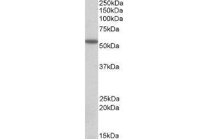 Western Blotting (WB) image for Desmin (DES) peptide (ABIN369745) (Desmin (DES) Peptid)