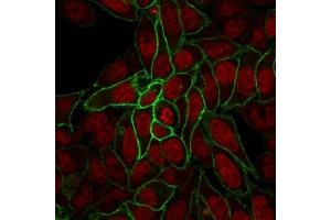 Confocal Immunofluorescence image of HeLa cells using Beta-Catenin Mouse Recombinant Monoclonal Ab (rCTNNB1/2173).