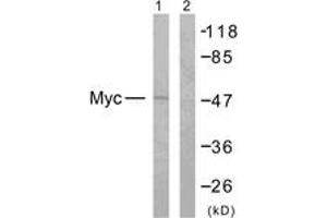 Western blot analysis of extracts from NIH-3T3 cells, treated with EGF 200ng/ml 30', using MYC (Ab-358) Antibody. (c-MYC Antikörper  (AA 325-374))