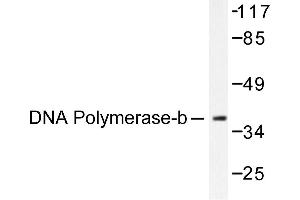 Image no. 1 for anti-Polymerase (DNA Directed), beta (POLB) antibody (ABIN265385) (POLB Antikörper)