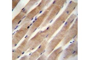 RHEB antibody immunohistochemistry analysis in formalin fixed and paraffin embedded human skeletal muscle. (RHEB Antikörper  (AA 104-134))