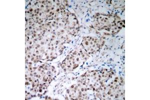 Immunohistochemistry (IHC) image for anti-Tumor Protein P53 (TP53) (pSer315) antibody (ABIN3020520) (p53 Antikörper  (pSer315))