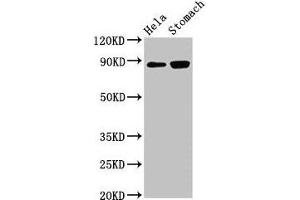 Western Blot Positive WB detected in: Hela whole cell lysate, Rat stomach tissue All lanes: ASAH2 antibody at 3 μg/mL Secondary Goat polyclonal to rabbit IgG at 1/50000 dilution Predicted band size: 86, 82 kDa Observed band size: 86 kDa (ASAH2 Antikörper  (AA 255-506))