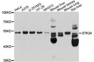 Western blot analysis of extracts of various cell lines, using STK24 antibody. (STK24 Antikörper)