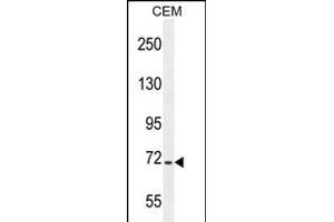 STIM1 Antibody (C-term) (ABIN654073 and ABIN2843969) western blot analysis in CEM cell line lysates (35 μg/lane). (STIM1 Antikörper  (C-Term))
