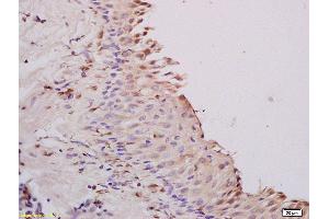 Formalin-fixed and paraffin embedded rat ovary tissue labeled with Anti A1BG Polyclonal Antibody,Unconjugated (ABIN872952) at 1:200 followed by conjugation to the secondary antibody and DAB staining. (A1BG Antikörper  (AA 301-400))
