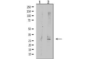 Western Blotting (WB) image for anti-Tumor Necrosis Factor Receptor Superfamily, Member 10c (TNFRSF10C) antibody (ABIN6265636)