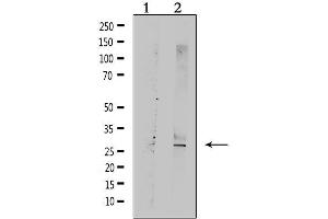 Western blot analysis of extracts from rat muscle, using TNFRSF10C  Antibody. (DcR1 Antikörper)