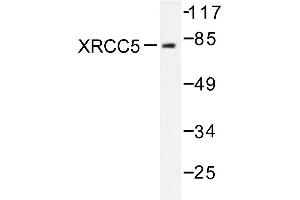 Image no. 1 for anti-X-Ray Repair Complementing Defective Repair in Chinese Hamster Cells 5 (Double-Strand-Break Rejoining) (XRCC5) antibody (ABIN271983) (XRCC5 Antikörper)