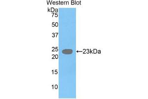 Western blot analysis of the recombinant protein. (GDF3 Antikörper  (AA 251-364))