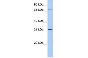 WB Suggested Anti-IDI1 Antibody Titration: 0. (IDI1 Antikörper  (Middle Region))