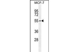 PCA Antibody (C-term) (ABIN655112 and ABIN2844743) western blot analysis in MCF-7 cell line lysates (35 μg/lane). (PMPCA Antikörper  (C-Term))