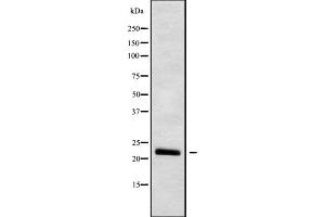 Western blot analysis IFNW1 using HUVEC whole cell lysates (IFNW1 Antikörper  (C-Term))