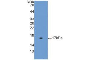 Western blot analysis of recombinant Mouse IL1F9. (IL1F9 Antikörper  (AA 5-149))