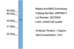 WB Suggested Anti-ERCC8  Antibody Titration: 0. (ERCC8 Antikörper  (Middle Region))