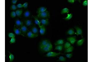 Immunofluorescence staining of A549 cells with ABIN7147850 at 1:133, counter-stained with DAPI. (CLTCL1 Antikörper  (AA 1423-1566))