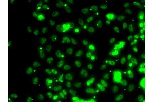 Immunofluorescence analysis of HeLa cells using SECISBP2 antibody (ABIN5974073). (SECISBP2 Antikörper)