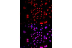 Immunofluorescence analysis of U2OS cells using RFC4 antibody (ABIN5973195). (RFC4 Antikörper)
